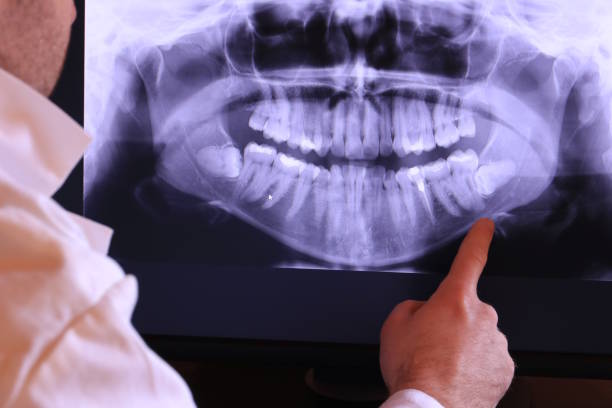 Best Cracked Tooth Emergency Dentist  in Chester Gap, VA